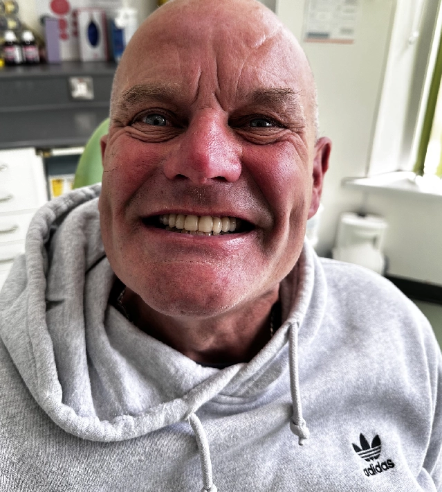 A man with a shaved head smiling for the camera.